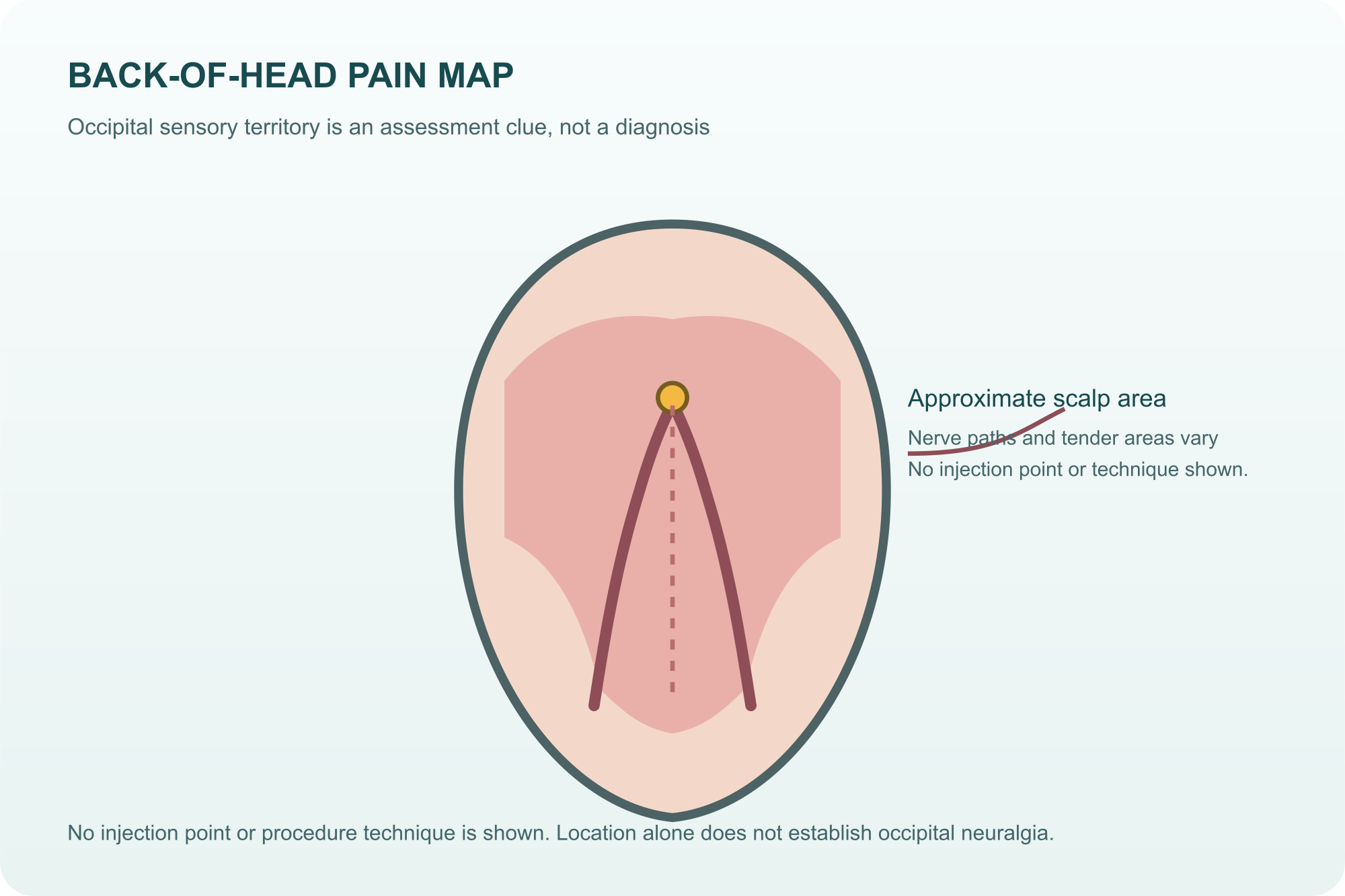 Educational illustration of an approximate occipital sensory area across the back of the head